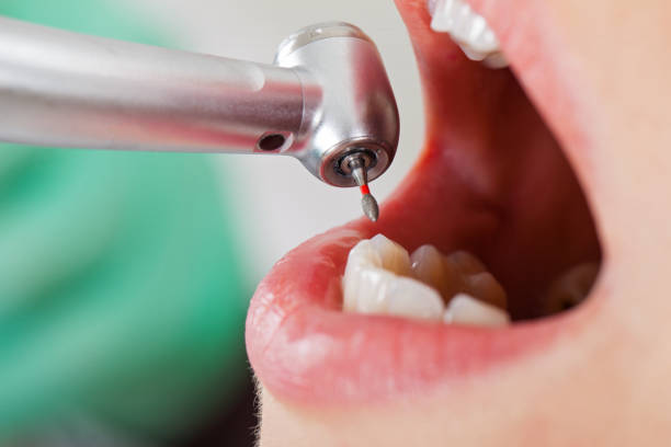 Best Urgent Tooth Repair  in Norton, KS